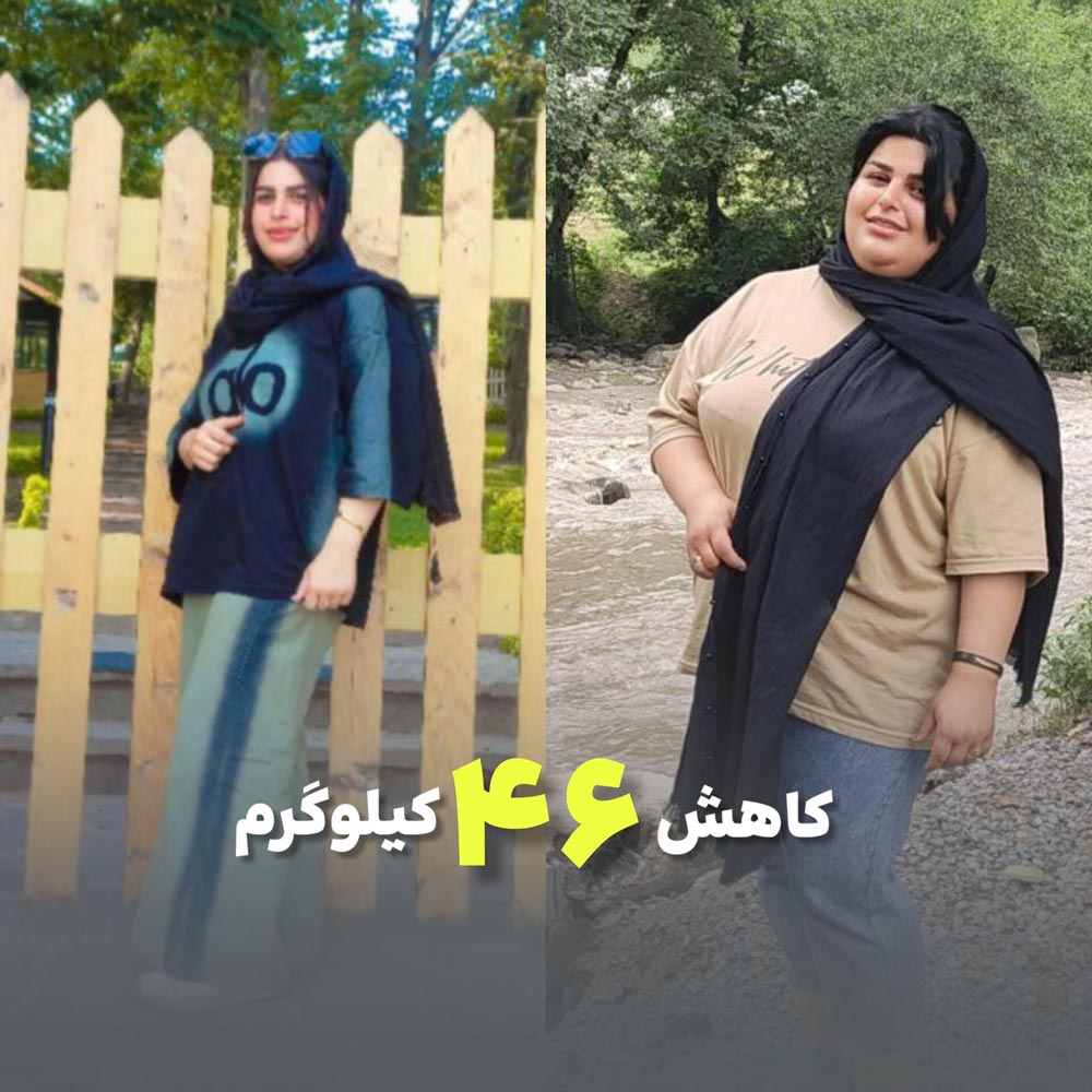 وزن اولیه 105 . وزن بعدی 59  یک سال بعد اسلیو